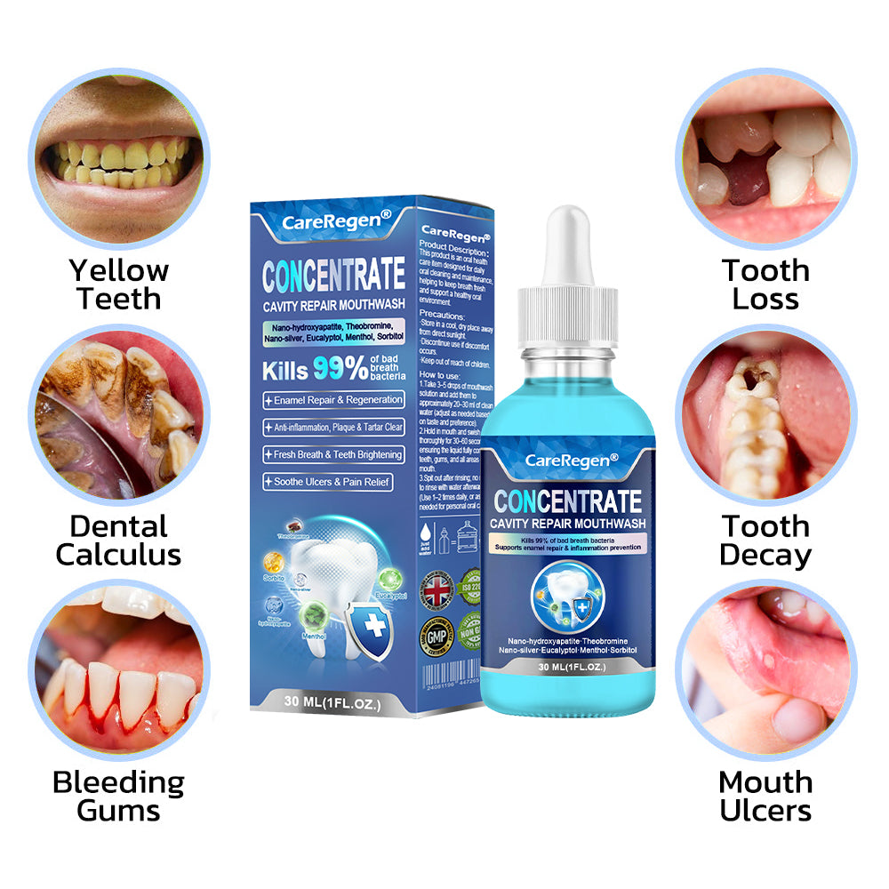 Official Store：🏆CareRegen® CONCENTRATE REPAIR MOUTHWASH(Dentist recommended)(Flying Off the Shelves: 100,000 Bottles Sold!)🎁