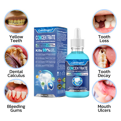 Official Store：🏆CareRegen® CONCENTRATE REPAIR MOUTHWASH(Dentist recommended)(Flying Off the Shelves: 100,000 Bottles Sold!)🎁