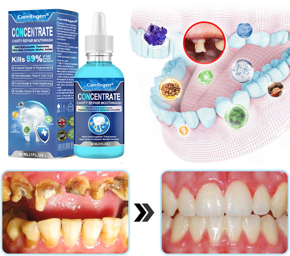 Official Store：🏆CareRegen® CONCENTRATE REPAIR MOUTHWASH(Dentist recommended)(Flying Off the Shelves: 100,000 Bottles Sold!)🎁