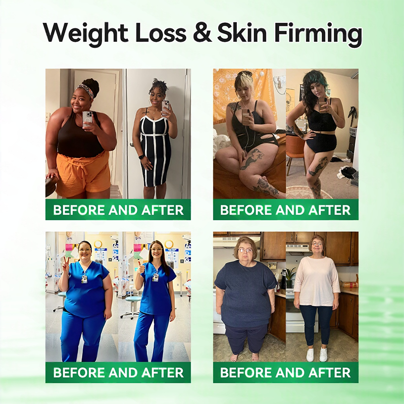 𝑶𝒇𝒇𝒊𝒄𝒊𝒂𝒍 𝑺𝒕𝒐𝒓𝒆 | ❤️‍🔥Healrize®𝑴𝒐𝒓𝒊𝒏𝒈𝗮 · 𝗕𝗲𝗿𝗯𝗲𝗿𝙞𝙣𝙚 × 𝙉𝘼𝐃+ 𝟏𝟎-𝐢𝐧-𝟏 𝗔𝗱𝘃𝗮𝗻𝗰𝙚𝙙 𝙉𝙖𝙣𝙤 𝙈𝙞𝙘𝙧𝙤𝙣𝙚𝙚𝐝𝐥𝐞 𝐏𝐚𝐭𝙘𝙝🇬🇧(𝐉𝐮𝐬𝐭 𝐨𝐧𝐜𝐞 𝐚 𝐝𝐚𝐲, 𝐯𝐢𝐬𝐢𝐛𝐥𝐞 𝐜𝐡𝐚𝐧𝐠𝐞𝐬 𝐢𝐧 𝟕 𝐝𝐚𝐲𝐬） ✅ 𝐅𝐨𝐫 𝐨𝐛𝐞𝐬𝐢𝐭𝐲, 🅛🅞🅞🅢🅔 🅢🅚🅘🅝,𝐝𝐢𝐚𝐛𝐞𝐭𝐞𝐬, 𝐬𝐥𝐞𝐞𝐩 𝐚𝐩𝐧𝐞𝐚, 𝐣𝐨𝐢𝐧𝐭 𝐢𝐬𝐬𝐮𝐞𝐬, 𝐚𝐧𝐝 𝐦𝐨𝐫𝐞 🩵