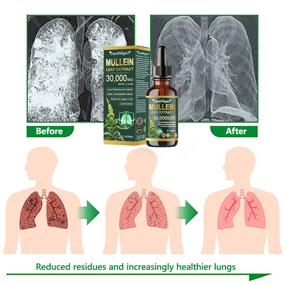 𝗢𝗳𝗳𝗶𝗰𝗶𝗮𝗹 𝗦𝘁𝗼𝗿𝗲:CareRegen®❤️‍🔥 𝗢𝗿𝗴𝗮𝗻𝗶𝗰 𝗟𝘂𝗻𝗴 𝗖𝗹𝗲𝗮𝗻𝘀𝗶𝗻𝗴 𝗠𝘂𝗹𝗹𝗲𝗶𝗻 𝗟𝗲𝗮𝗳 𝗘𝘅𝘁𝗿𝗮𝗰𝘁 𝗗𝗿𝗼𝗽𝘀  𝐂𝐥𝐢𝐧𝐢𝐜𝐚𝐥𝐥𝐲 𝐩𝐫𝐨𝐯𝐞𝐧, 𝐡𝐢𝐠𝐡𝐥𝐲 𝐜𝐨𝐧𝐜𝐞𝐧𝐭𝐫𝐚𝐭𝐞𝐝 𝐟𝐨𝐫𝐦𝐮𝐥𝐚 𝐭𝐡𝐚𝐭 𝐫𝐞𝐥𝐢𝐞𝐯𝐞𝐬 𝐜𝐨𝐮𝐠𝐡, 𝐩𝐡𝐥𝐞𝐠𝐦, 𝐚𝐬𝐭𝐡𝐦𝐚 & 𝐂𝐎𝐏𝐃 — 𝐛𝐫𝐞𝐚𝐭𝐡𝐞 𝐞𝐚𝐬𝐢𝐞𝐫, 𝐟𝐚𝐬𝐭𝐞𝐫. 💙