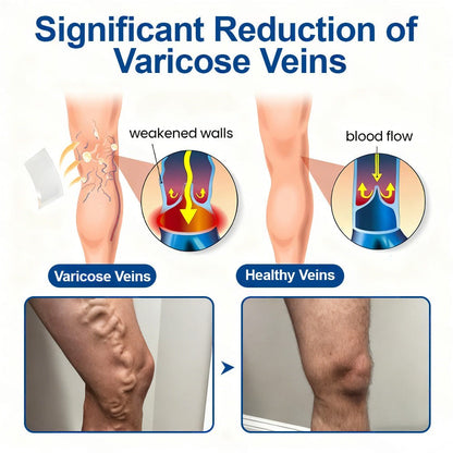 🇬🇧👨‍⚕️👍✅Healrize® VeinTarget Microneedle Patch⚡Instant Relief, Long-Term Results🧡