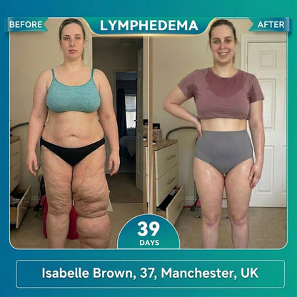 𝐎𝐟𝐟𝐢𝐜𝐢𝐚𝐥 𝐁𝐫𝐚𝐧𝐝 𝐒𝐭𝐨𝐫𝐞 |✅ 𝐇𝐞𝐚𝐥𝐫𝐢𝐳𝐞® 𝟐𝟎𝟐𝟔 💕𝟏𝟎-𝐈𝐧-𝟏 𝐌𝐨𝐫𝐢𝐧𝐠𝐚 * 𝐁𝐞𝐫𝐛𝐞𝐫𝐢𝐧𝐞 * 𝐍𝐀𝐃+ 𝐌𝐞𝐭𝐚𝐛𝐨𝐥𝐢𝐬𝐦 𝐒𝐥𝐢𝐦𝐦𝐢𝐧𝐠 𝐄𝐬𝐬𝐞𝐧𝐭𝐢𝐚𝐥 𝐎𝐢𝐥 𝐍𝐨𝐬𝐞 𝐂𝐥𝐢𝐩 (𝐅𝐨𝐫 𝐀𝐥𝐥 𝐋𝐲𝐦𝐩𝐡𝐚𝐭𝐢𝐜 𝐏𝐫𝐨𝐛𝐥𝐞𝐦𝐬 & 𝐎𝐛𝐞𝐬𝐢𝐭𝐲)🩵